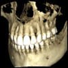 Planmeca PLANMECA PROMAX 3D Classic Panorex Cone Beam Planmeca PLANMECA PROMAX 3D Classic Panorex Cone Beam