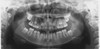 Planmeca PLANMECA PROMAX 3D Classic Panorex Cone Beam Planmeca PLANMECA PROMAX 3D Classic Panorex Cone Beam