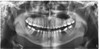 Planmeca PLANMECA PROMAX 3D Classic Panorex Cone Beam Planmeca PLANMECA PROMAX 3D Classic Panorex Cone Beam