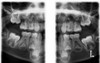 Planmeca PLANMECA PROMAX 3D Classic Panorex Cone Beam Planmeca PLANMECA PROMAX 3D Classic Panorex Cone Beam