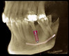 Planmeca PLANMECA PROMAX 3D Classic Panorex Cone Beam Planmeca PLANMECA PROMAX 3D Classic Panorex Cone Beam