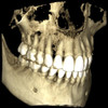 Planmeca PLANMECA PROMAX 3D Classic Panorex Cone Beam Planmeca PLANMECA PROMAX 3D Classic Panorex Cone Beam