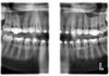 Planmeca PLANMECA PROMAX 3D Classic Panorex Cone Beam Planmeca PLANMECA PROMAX 3D Classic Panorex Cone Beam