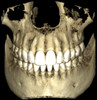 Planmeca PLANMECA PROMAX 3D Classic Panorex Cone Beam Planmeca PLANMECA PROMAX 3D Classic Panorex Cone Beam