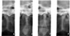 Planmeca PLANMECA PROMAX 3D Classic Panorex Cone Beam Planmeca PLANMECA PROMAX 3D Classic Panorex Cone Beam