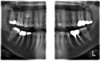 Planmeca PLANMECA PROMAX 3D Classic Panorex Cone Beam Planmeca PLANMECA PROMAX 3D Classic Panorex Cone Beam