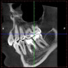 Planmeca PLANMECA PROMAX 3D Classic Panorex Cone Beam Planmeca PLANMECA PROMAX 3D Classic Panorex Cone Beam