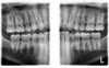 Planmeca PLANMECA PROMAX 3D Classic Panorex Cone Beam Planmeca PLANMECA PROMAX 3D Classic Panorex Cone Beam