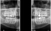 Carestream Dental CARESTREAM CS 8100 3D Panorex Cone Beam Carestream Dental CARESTREAM CS 8100 3D Panorex Cone Beam