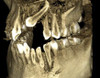 Planmeca PLANMECA PROMAX 3D Plus Panorex Cone Beam