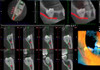 Planmeca PLANMECA PROMAX 3D Plus Panorex Cone Beam