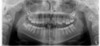 Planmeca PLANMECA PROMAX 3D Plus Panorex Cone Beam