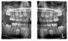 Planmeca PLANMECA PROMAX 3D Plus Panorex Cone Beam