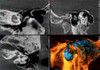 Planmeca PLANMECA PROMAX 3D Plus Panorex Cone Beam