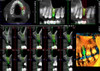 Planmeca PLANMECA PROMAX 3D Plus Panorex Cone Beam