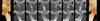 i-CAT i-CAT FLX MV Cone Beam i-CAT i-CAT FLX MV Cone Beam