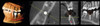 Instrumentarium INSTRUMENTARIUM OP300 Maxio Panorex Cone Beam - Large FOV Instrumentarium INSTRUMENTARIUM OP300 Maxio Panorex Cone Beam - Large FOV