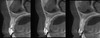 Gendex GENDEX GXDP-700 Panorex Ceph Cone Beam