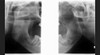 Gendex GENDEX GXDP-700 Panorex Ceph Cone Beam