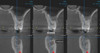 Gendex GENDEX GXDP-700 Panorex Ceph Cone Beam