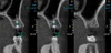 Gendex GENDEX GXDP-700 Panorex Ceph Cone Beam