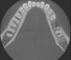 Gendex GENDEX GXDP-700 Panorex Ceph Cone Beam