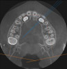 Gendex GENDEX GXDP-700 Panorex Ceph Cone Beam