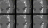 Gendex GENDEX GXDP-700 Panorex Ceph Cone Beam