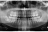 Gendex GENDEX GXDP-700 Panorex Ceph Cone Beam