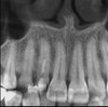 Gendex GENDEX GXDP-700 Panorex Ceph Cone Beam