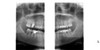 Gendex GENDEX GXDP-700 Panorex Ceph Cone Beam