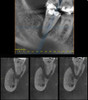 Gendex GENDEX GXDP-700 Panorex Ceph Cone Beam