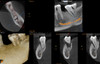 Carestream Dental CARESTREAM CS 8100 3D Panorex Ceph Cone Beam