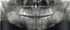 Carestream Dental CARESTREAM CS 8100 3D Panorex Ceph Cone Beam