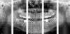 Carestream Dental CARESTREAM CS 8100 3D Panorex Ceph Cone Beam