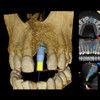 Carestream Dental CARESTREAM CS 8100 3D Panorex Ceph Cone Beam