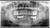 Sirona SIRONA ORTHOPHOS S 2D Panorex 