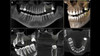 Sirona SIRONA ORTHOPHOS SL 3D Panorex + Cone Beam +Ceph 