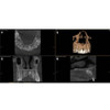 Sirona SIRONA AXEOS 3D Panorex + Cone Beam 