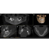 Sirona SIRONA AXEOS 3D Panorex + Cone Beam 