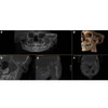 Sirona SIRONA AXEOS 3D Panorex + Cone Beam 