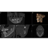 Sirona SIRONA AXEOS 3D Panorex + Cone Beam 