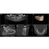 Sirona SIRONA AXEOS 3D Panorex + Cone Beam 
