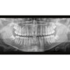 Sirona SIRONA AXEOS 3D Panorex + Cone Beam 