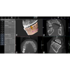 Acteon X-Mind Prime Panorex + Ceph + Cone Beam