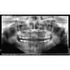 Acteon ACTEON X-MIND PRIME 3D PANOREX + CEPH + CONE BEAM 