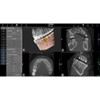 Acteon ACTEON X-MIND PRIME 3D PANOREX + CEPH + CONE BEAM 