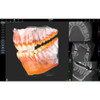 Acteon ACTEON X-MIND PRIME 3D PANOREX + CEPH + CONE BEAM 