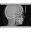 Acteon ACTEON X-MIND PRIME 3D PANOREX + CEPH + CONE BEAM 