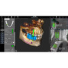 Acteon ACTEON X-MIND PRIME 3D PANOREX + CEPH + CONE BEAM 